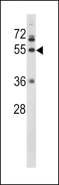 Polyclonal Rabbit anti-Human FGG / Fibrinogen Gamma Antibody (aa420-449, IHC, IF, WB)