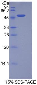 Human ITGA5/Integrin Alpha 5/CD49e Protein (Recombinant His-GST)