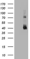 Monoclonal Mouse anti-Human CD2 Antibody (clone OTI1C5, IHC, WB)
