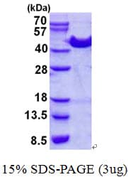 Human ACAT1 Protein (Recombinant His)