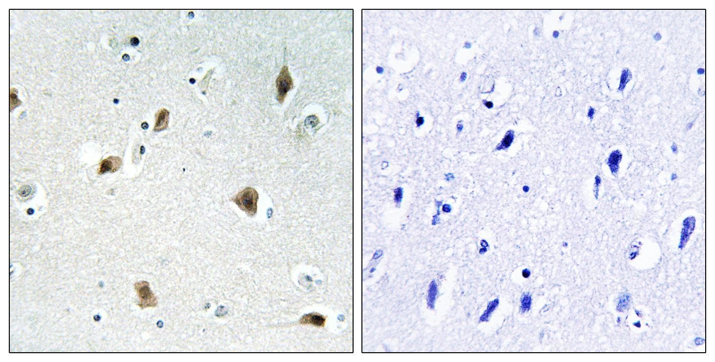 CDKN1B / p27 Kip1 Antibody (Ab-157)