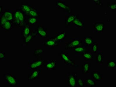 SMARCD1 / BAF60A Antibody