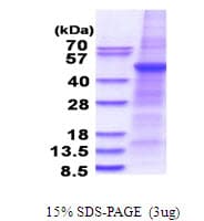 Human PSPLA1 / Phospholipase A1 Protein (Recombinant His)