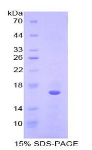 Human FGF23 Protein (Recombinant His)
