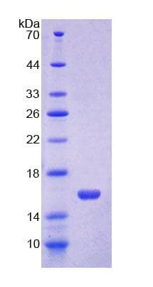 Mouse OCLN / Occludin Protein (Recombinant His)