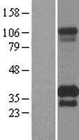 TMEM55B Protein (Over-Expression Lysate Myc-DDK (Flag))
