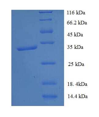 Human TMEM44 Protein (Recombinant His-SUMO)