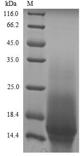 Mouse AQP4 / Aquaporin 4 Protein (Recombinant 6His-Myc, C-terminus)