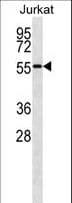 NUP50 Antibody