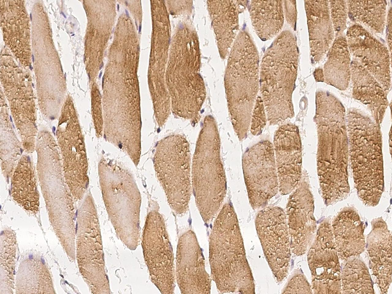 KBTBD5 Antibody