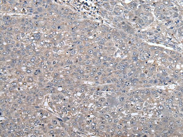 Polyclonal Rabbit anti-Human ARL1 Antibody (IHC, WB)