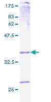 Human PROK1 / EG-VEGF Protein (Recombinant GST)