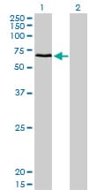 CACNB1 Antibody (clone 1G6)