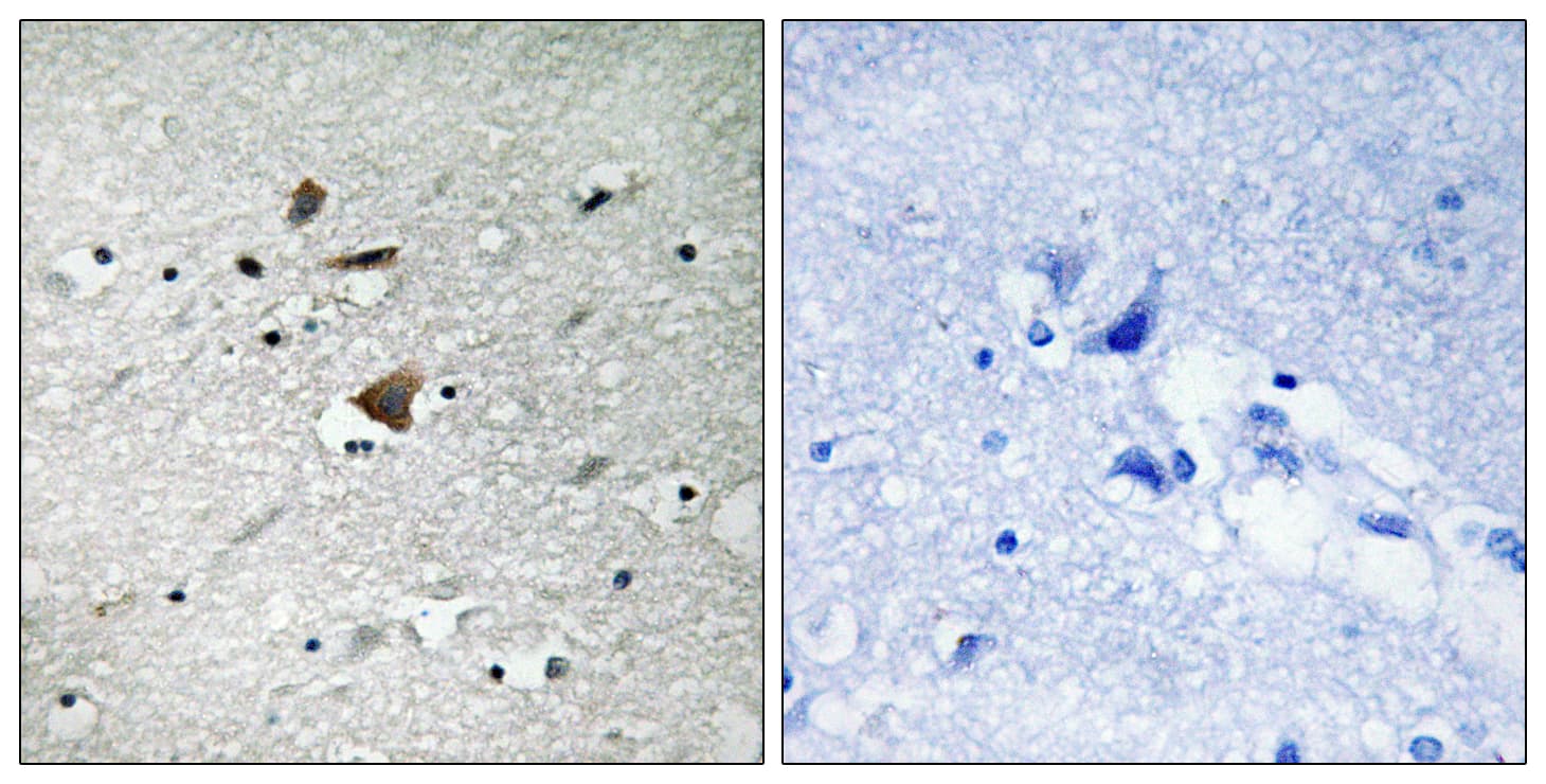Polyclonal Rabbit anti-Human ANAPC1 / APC1 Antibody (aa321-370, IHC)