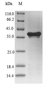 Human CXCR2 Protein (Recombinant 6His-SUMO, N-terminus)
