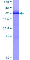 Human PPIE / Cyclophilin E Protein (Recombinant GST)