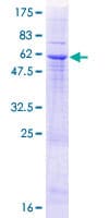 Human ITLN1 / Omentin Protein (Recombinant GST)