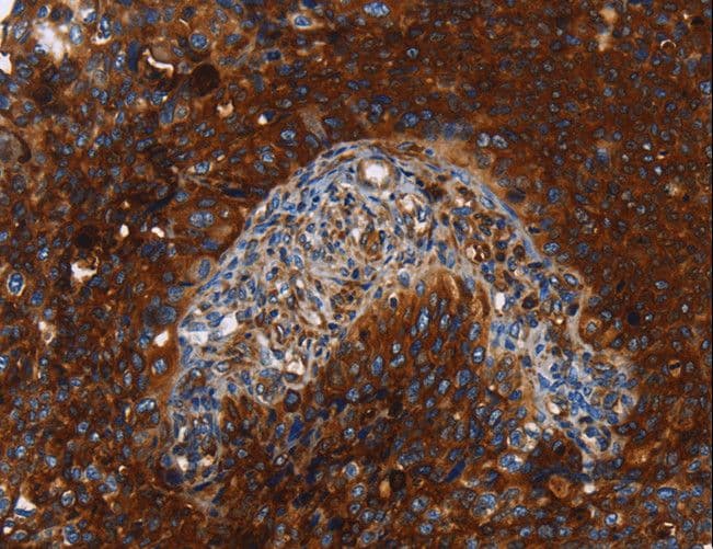 Polyclonal Rabbit anti-Human MSLN / Mesothelin Antibody (IHC)