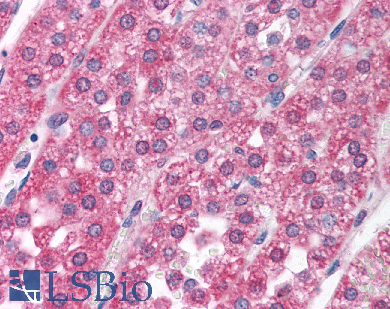Polyclonal Rabbit anti-Human Recoverin Antibody (aa131-180, IHC, WB)
