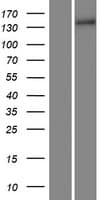 Human COL15A1 / Collagen XV Alpha 1 Protein (Over-Expression Lysate Myc-DDK (Flag))