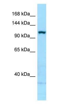 ITGA5/Integrin Alpha 5/CD49e Antibody (aa863-912)