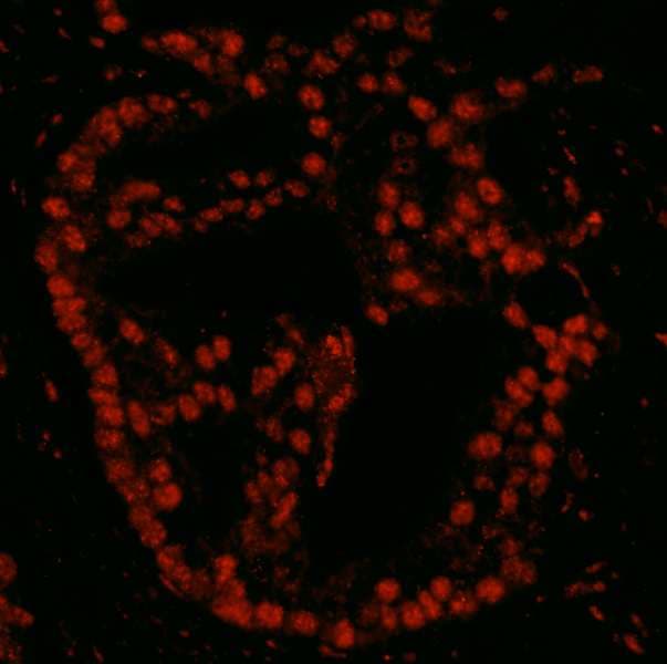 PDS5B / AS3 Antibody (aa1200-1250)