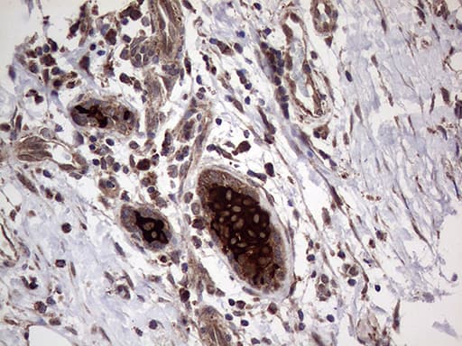Monoclonal Mouse anti-Human AGR2 Antibody (clone OTI3B5, aa21-175, IHC, WB)