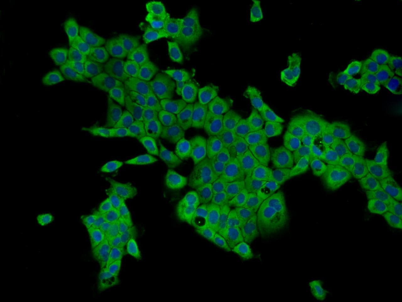 CAMKK2 Antibody