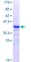 Human TROP2 / TACSTD2 Protein (Recombinant GST, N-terminus)