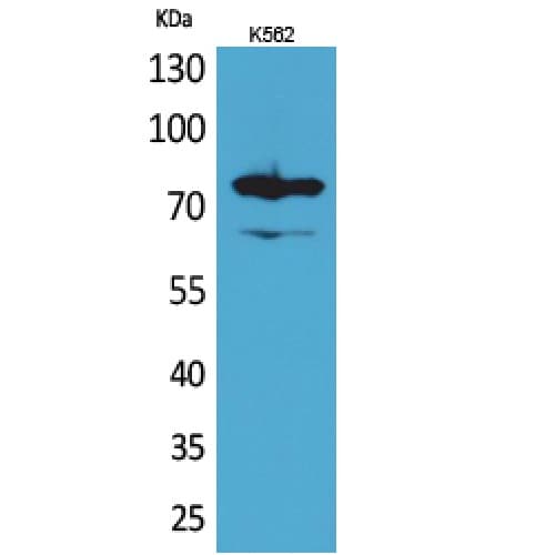 Polyclonal Rabbit anti-Human FOXP1 Antibody (C-terminal, WB)