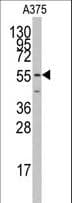 PTRF / CAVIN Antibody (aa363-390)
