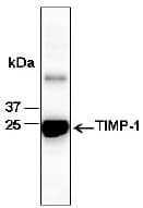 TIMP1 Antibody (Preservative Free)