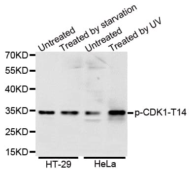 Polyclonal Rabbit anti-Human CDK1 / CDC2 Antibody (phospho-Thr14, IF, WB)