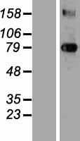 TGM3 / Transglutaminase 3 Protein (Over-Expression Lysate Myc-DDK (Flag))