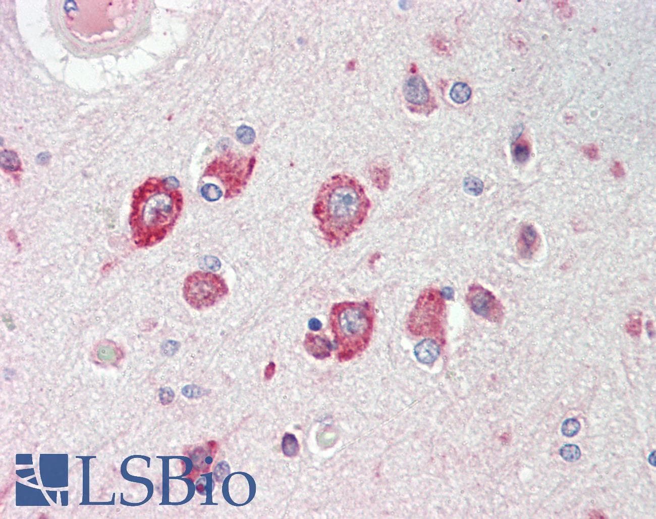 IHC-plus™ CACNG8 Antibody (aa90-119)