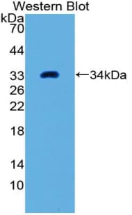 FRA-1 / FOSL1 Antibody (aa1-273)