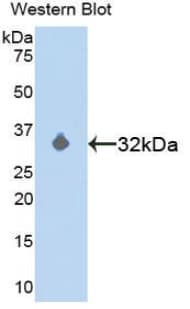 MAP2K3 / MEK3 / MKK3 Antibody (aa99-343)