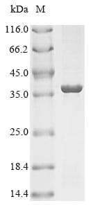 Rhizobium leguminosarum nifH Protein (Recombinant 10His-GST, N-terminus + Myc, C-terminus)