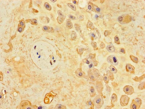 Polyclonal Rabbit anti-Human KIAA1409 / UNC79 Antibody (IHC, IF)