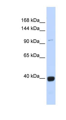VAV1 / VAV Antibody (C-Terminus)