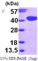 Human GALM / Mutarotase Protein (Recombinant His)