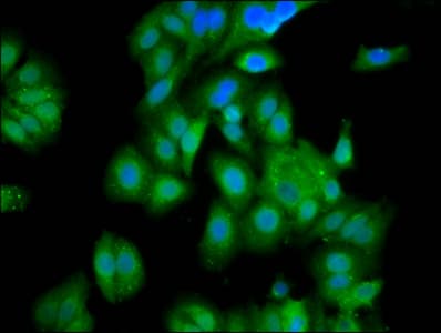 GATB / PET112 Antibody