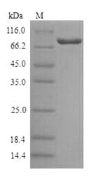 Human GALC / Galactocerebrosidase Protein (Recombinant 6His, N-terminus)