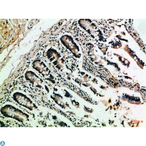NFAT1 / NFATC2 Antibody