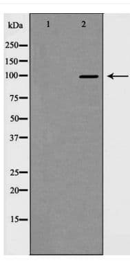 Polyclonal Rabbit anti-Human HDAC7 Antibody (IHC, WB)