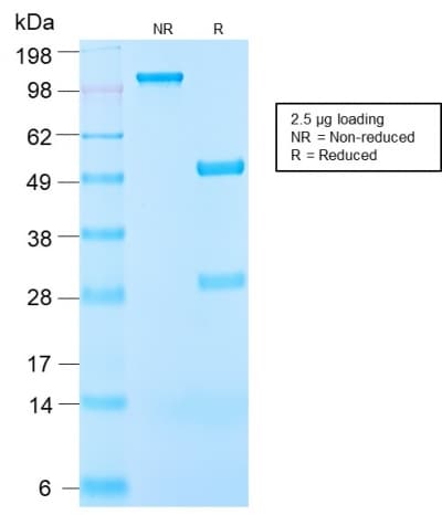 Recombinant Monoclonal Rabbit anti-Human IGF1 Antibody (clone IGF1/2872R, Azide-free,Carrier-free, IF)