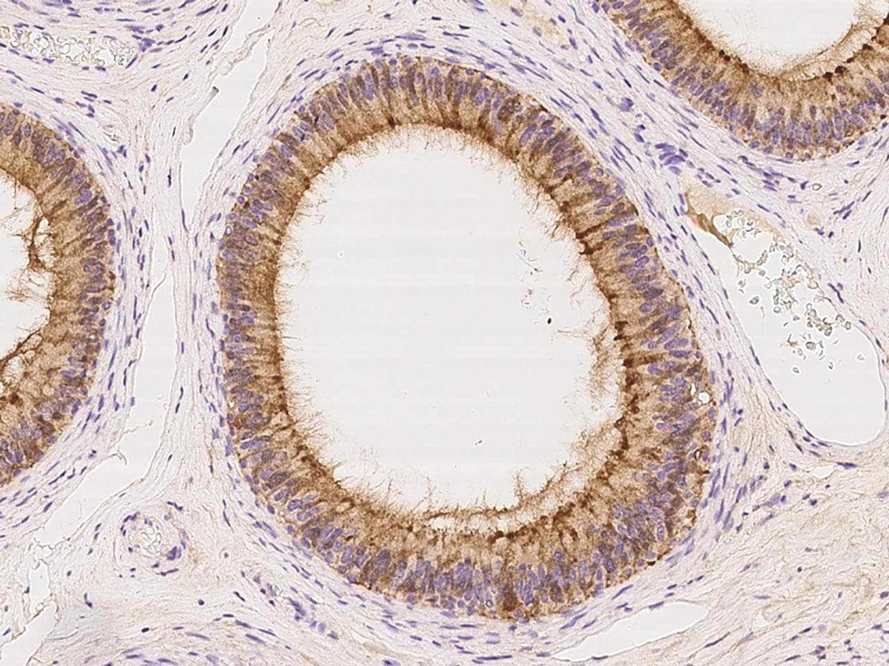 Polyclonal Rabbit anti-Human Prostaglandin D Synthase Antibody (IHC)