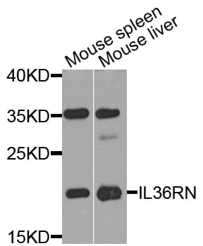 Polyclonal Rabbit anti-Human IL36RN / IL1F5 Antibody (WB)