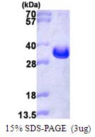 Human LAT Protein (Recombinant His)
