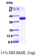 Human PNP / Nucleoside Phosphorylase Protein (Recombinant His)